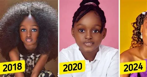 Voici à quoi ressemble aujourd’hui "la plus belle petite fille du monde ...